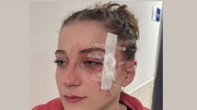 Kadınların basketbol maçında yumruk yumruğa!..